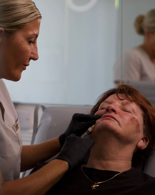 Close-up of a lip enhancement treatment being carried out at Maldiva Aesthetics
